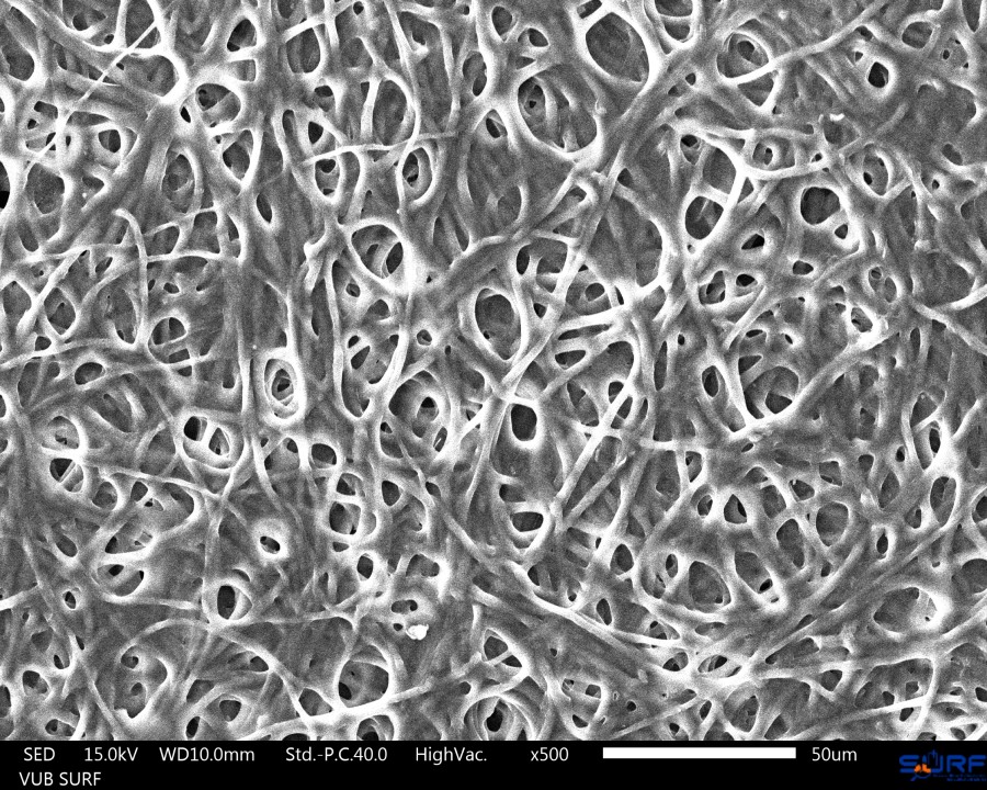 nc-hyphae-500x_1_aurelie-van-wylick-micr_low.jpg